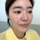강남역 토닝 트리플토닝+크라이오 후기