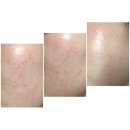[ 2주 사용 후기] 아크웰 아큐리얼 나인 컨트롤 엑스 크림 / 겔