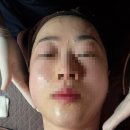 스킨케어조 | 부평피부관리 스킨케어톡_브이라인 링클톡 후기