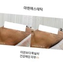 마렌에스테틱 이미지