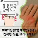 강서성모내과의원 | 서울 강서구 류마티스내과 통풍 혈액검사 왜 필요할까요?
