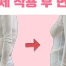 바른자세교정 이미지