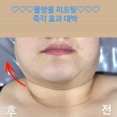 피부,맑음 이미지