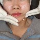 도안남로 | 관저동 피부관리 후기! 초희네 리베룩 받고 모공이 확 줄었어요