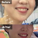 마미케어 브이쎄라 내돈내산 ems 효과 후기 사용법 꿀팁 총정리