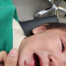 정자동 한땀성형외과 13개월 아기 입술 아래 상처 봉합+프락셀 1차 레이저 후기