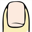 손톱모양 이미지
