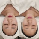 베이시스 | [압구정 피부관리] 스파유 압구정점 베이시스케어 후기