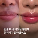 필러 | 압구정로데오역 피부과 첫 입술필러 내돈내산 후기