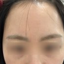 우태자헤어라인 | 갈매눈썹정리 인브로우 헤어라인 이마 눈썹 왁싱 후기