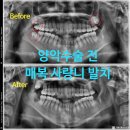 서울유플란트치과의원 이미지