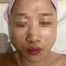 원주 피부관리 거꾸로가는시간 따뚜점에서 물광 윤곽 리프팅