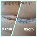 디에스레이션 | 진해피부관리 테라노바후기