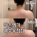 [약손명가 여수웅천점] 여수 웨딩관리 여수 마사지
