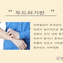 서울피부과 이미지