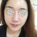 밝은미래의원 네이버블로그