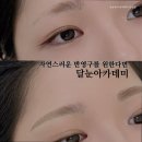 달눈뷰티
