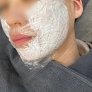 청주 피부과에서 첫 레이저리프팅 슈링크 300샷 도전해 본 후기
