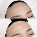 서면 헤어라인 왁싱 잘하는 곳 &#34;디어민뷰티&#34;