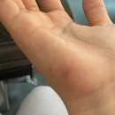 양평맑은피부과의원 네이버블로그