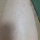 유라이크 헤어 | 제모고민?다 드루와 유라이크 레이저 제모기 2년사용 후기