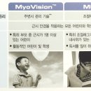엠씨렌즈 이미지