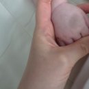 D+191 에스앤유피부과 이소성몽고반점 밀크반점 레이저 3차후기(내돈내산)