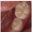 이정수이비인후과의원 | 인천양심치과 과잉진료 피하고 싶다면 필독!
