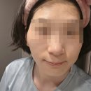 미라클코디 | 브릴로즈 미라클 울트라 유스 하이드레이팅 젤 마스크 체험단2기 후기