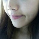 뉴욕연세치과 후기 * 앞니 라미네이트와 치아미백