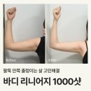 지내역(2번출구 옆) | 강남구청 피부과 팔뚝 바디리니어지 1000샷 내돈내산 후기(통증 효과 소요시간)