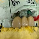 마스타치과기공소 이미지
