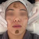 [익산] 모현동 피부관리는 ‘에르떼’ 해초필 관리 후기