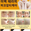 제이비비 이미지