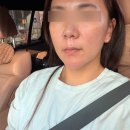 리멤버피부과의원(강서마곡점) | 쥬베룩볼륨, 올타이트리프팅 마곡피부과에서 피부탄력 만족 후기