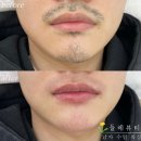 들레뷰티 이미지