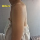 선릉바이오포톤 | 선릉피부관리 클로이에스테틱 엔더몰로지 후기