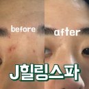 스파닉 | 대구 괄사관리 잘하는 J힐링스파에서 피부관리 받았어요: D