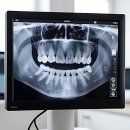 e가지런한치과의원 | 가지런한 미소 장착 완료 후기