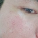 엔케이메디컬 | 닥터유엔케이 리프팅크림 사용 후기!