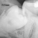 섬세한사랑니치과의원 이미지