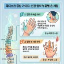 고려척척신경외과의원 | 고개 오래 숙일 때 나타나는 손가락 저림과 척추의 연결성 알아보기