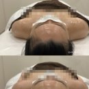 도도 | 고덕 평택피부관리 뼈말라 팔뚝관리 도도에스테틱 솔직 후기