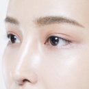 강남푸른안과의원 이미지