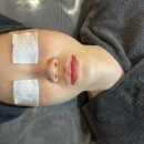 잠실 에스테틱 루미나에스테틱 후기