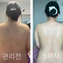 더케어 Daum카페
