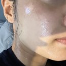 라 벨르 에스테틱 | 용인 피부관리] 벨르유 에스테틱 : 처인구 피부관리 문제성 트러블 피부 전문 관리(수분시그니처관리 후기)