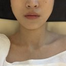 클리어스킨 | 대구 신부관리 추천! 클리어스킨케어 윤곽관리 얼굴+데콜테 관리 후기