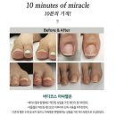 비키네일