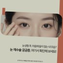 정승문성형외과의원 네이버블로그